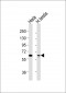 Artemis (pS516) Antibody